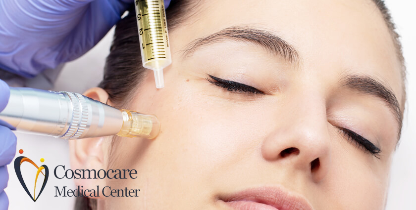 Mesotherapy in Dubai by Cosmocare Medical Center